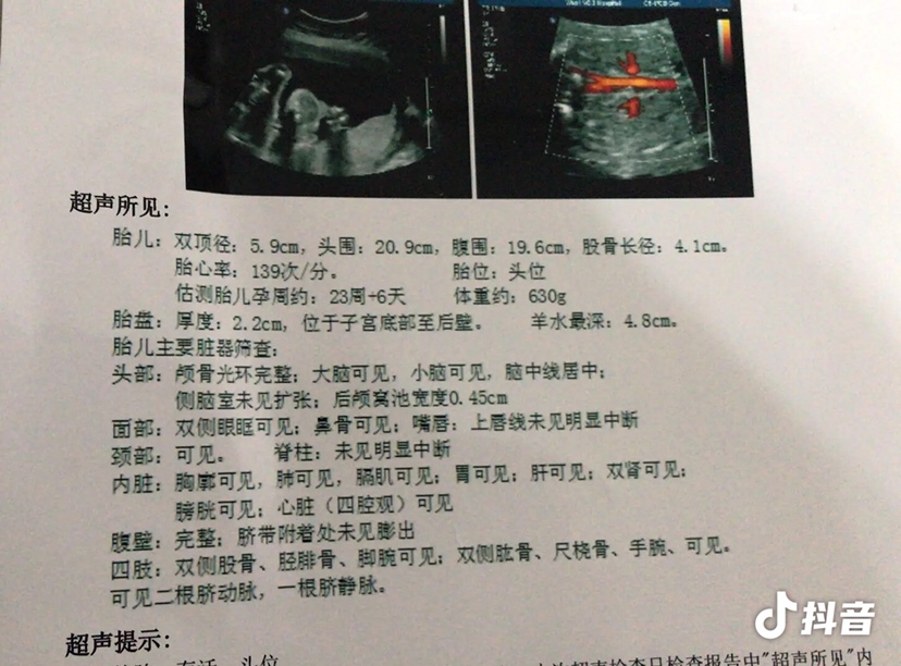 肚子是七个多月现在的肚型，三维是5个多月的时候做的，各位宝妈们，有没有人会看男宝女宝的，帮我看看，好好奇啊