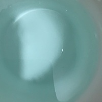 因为小区停水，导致整个小区回水，我老婆怀孕才4个月，误喝了淡蓝色的水，当时头晕呕吐，可能是洁厕灵或...