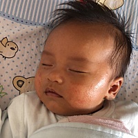 宝宝湿疹你们都是用什么擦好的啊？我的好久了都没好，烦