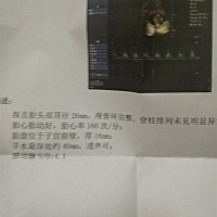 寶媽們幫我看一下是男孩女孩.一胎是男孩現在很想要個女寶寶