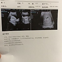 孕5周多，这两天有流一些褐色分泌物，这是怎么回事呢？问过朋友她说以前她也会这样医生说正常的，现在我...