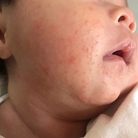 这个是什么啊，这边好了那边又长