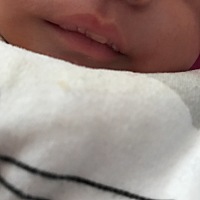 宝妈们想问一下宝宝上嘴唇总是有一层干干的皮  都裂口了怎么回事呢