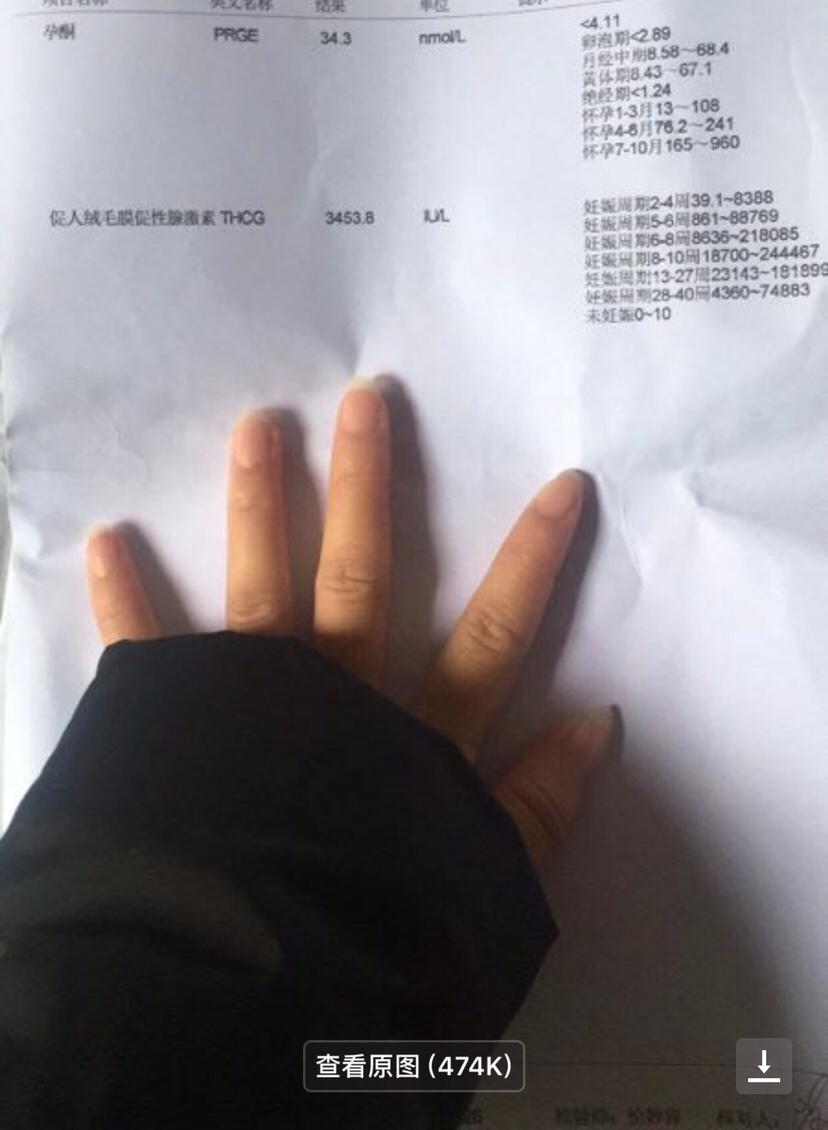 请教各位亲一下，我老婆怀孕一个月，但是去复查医生说是稽留流产第一是3月4号第二张是3月5号