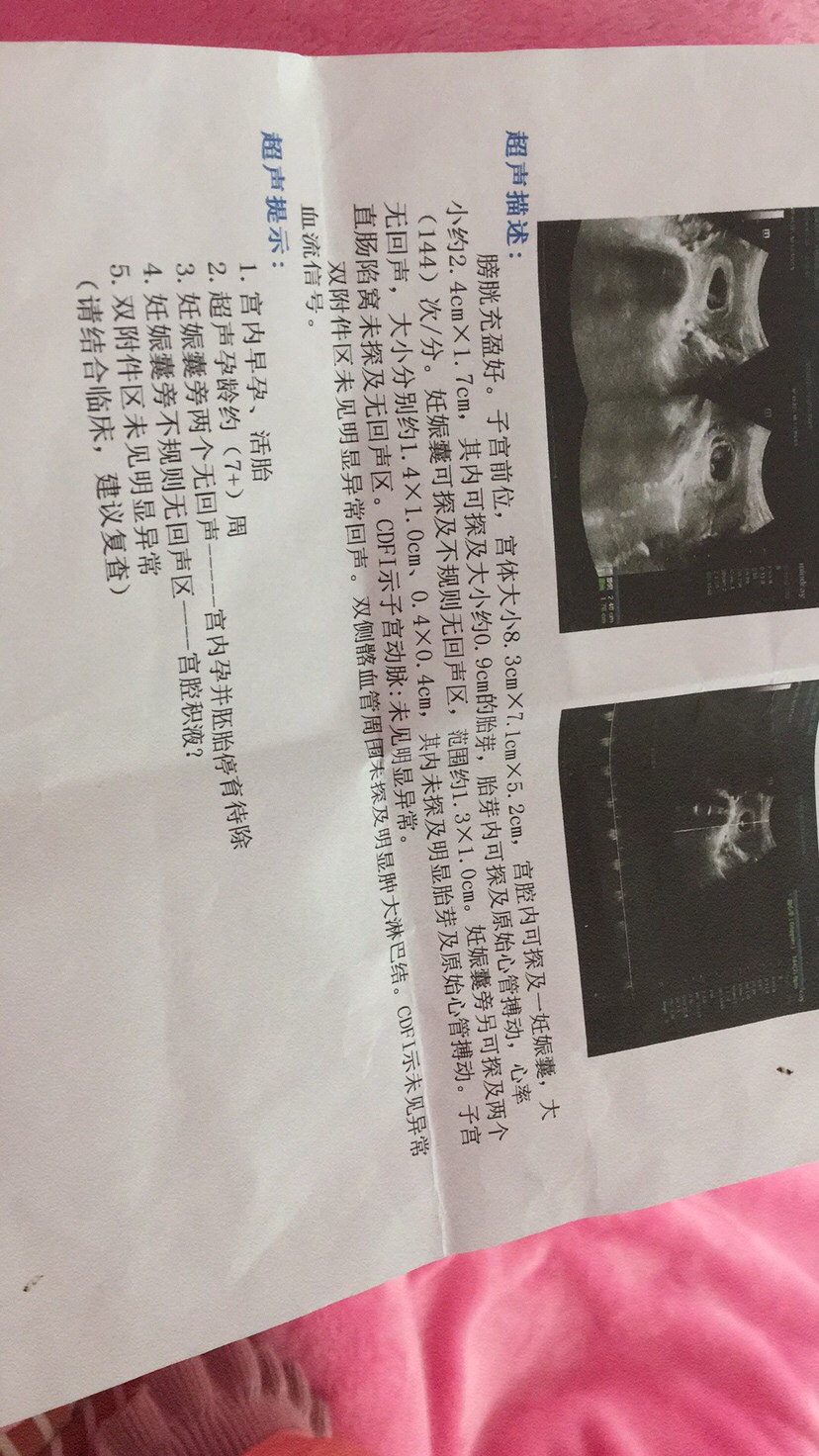 大家帮忙看看男孩女孩，谢谢了……