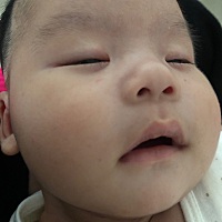 两个月宝宝眼圈发红 眼角比较严重 是热到了么 该怎么办啊？