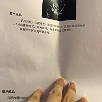 请问六周多了，还没有胎心胎芽，正常吗？