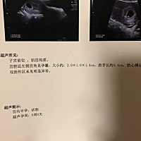 怀孕6周了，去检查的时候医生说是孩子在近宫角左侧。好担心啊。有没有准麻麻遇到过这种情况。帮忙回复一...