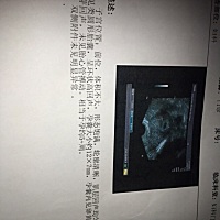 懂得帮我看看，男孩还是女孩