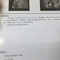 麻烦大家帮我看看检查单，最近这几天左右腹偶尔有刺痛感，伴有少量出血，最近还有点感冒，我有点担心宝...