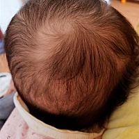 急急急。宝宝头发是怎么了？有部分是黄头发👱，没有黑色，有一样的宝妈没，这是怎么回事要紧吗？急急急