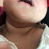 宝妈们 这是鹅口疮嘛？ 还是喂母乳的都这样？