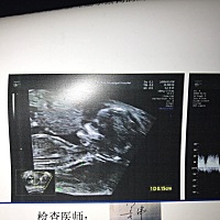 今天做的NT   小宝这是在干嘛？吹泡泡嘛？