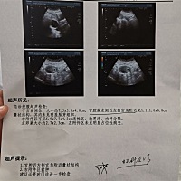 向亲们求助…怀孕4周，孕酮15.9，医生说太少，让我去急诊拍彩超 没有胎心胎芽，却发现着床位置在宫腔偏...