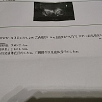 今天去医院正式检查，医生给开了hcg孕酮甲功，因为我说我一直有腹痛感，医生还开了阴超说确认一下宫内宫...