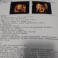 有懂的宝妈吗，在线等，急急急！！！