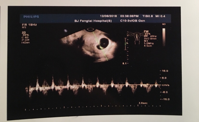 麻烦帮我看看男女呀？