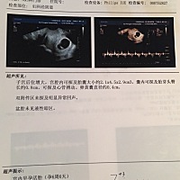 请问谁会看男女呀？ 麻烦帮我看看男女呀？