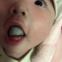 急舌胎厚白  喝奶粉食欲不振  怎么办