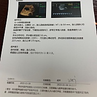 请问一下各位宝妈们，我的这个是男孩还是女孩？不过无论是男女我都爱❤️