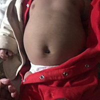 感觉宝宝腹围好宽，有同款宝宝吗？
