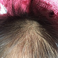 请问宝宝头发里是什么呀？和头皮屑一样，之前都没有，这要怎么清理呢？