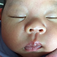 为什么宝宝鼻子会长东西一粒？，有人知道吗？