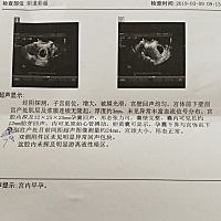 查男女 拜托大家帮我看看  能看出男女嘛，谢谢啦