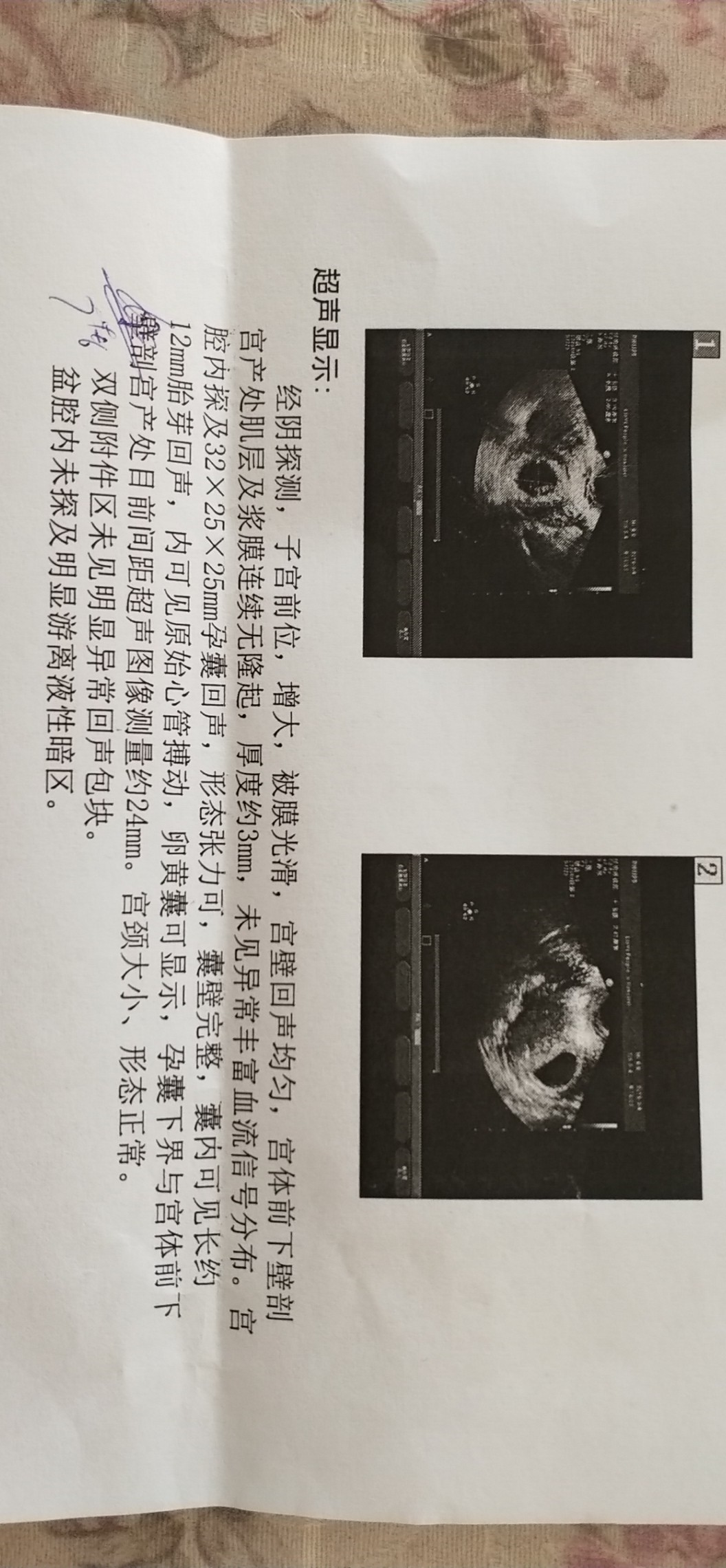 帮忙看看男女  谢谢