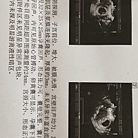 看男女 帮忙看看男女  谢谢