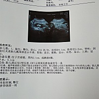 大家帮忙看看男孩女孩