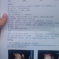 宝妈们，帮忙看看男孩女孩