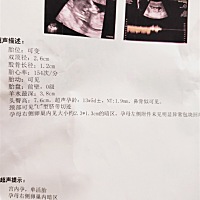 大伙给看看，这能看出男女吗😊