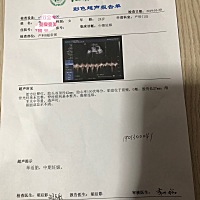 宝爸姓刘，宝妈姓李，是个乔治，麻烦各位宝爸宝妈们帮忙想个好听的名字