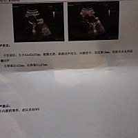 为什么呢 怀孕了又没有看到孕囊 有经历的快告诉我吧😬😬😬😬