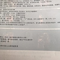 宝宝33+6周了  准备入手宝宝用品和衣服啦  有图的可以看看是男宝宝还是女宝宝呢？