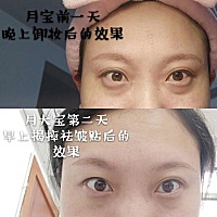 怀孕之后，雌激素分泌旺盛，发现越来越像黄脸婆了，有没有同感的宝妈呢，希望用用可以变回之前的模样