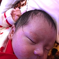 宝妈们知道这是什么吗，一热就很多，怎么样才能消退啊，急急急急急急