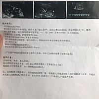 感觉第一胎生啥 压力也大😭