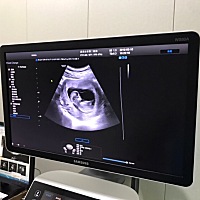 娱乐一下，这样能看男宝女宝吗，偷拍的。今天刚做的NT，附单子