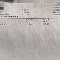 试纸检测出怀孕就去医院了，推算时间也就是33天左右！今天去医院检查，大夫在诊断处写的先兆性流产，我...