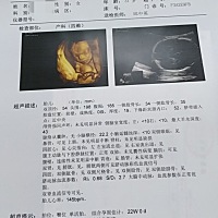 这个可以看出来是男孩还是女孩吗？