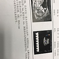 头胎，好奇是佩奇还是乔治。都会非常爱。