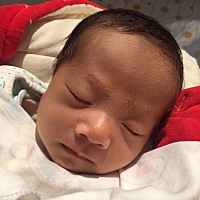 宝妈们，宝宝眉毛上长的什么？怎样可以去掉？