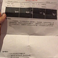 好担心啊，查血都怀孕了，今天查还是没有孕囊，请求各位有经验的孕妈帮我看看，医生说的话简直听不懂，...