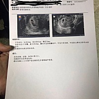 好开心啦，6周+，猜猜性别