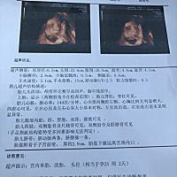 刚刚做的思维，检查了三次，医生用B超头给敲醒了，才给了个侧脸，大神们能帮忙看下是乔治还是佩奇吗？