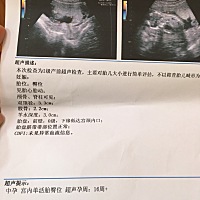 16周了，今天刚做的B超，听说检查单上可以看男女，哈哈，求指教！