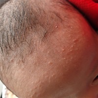 宝宝头上这长的是什么？