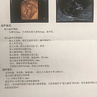 请问这个正常吗？